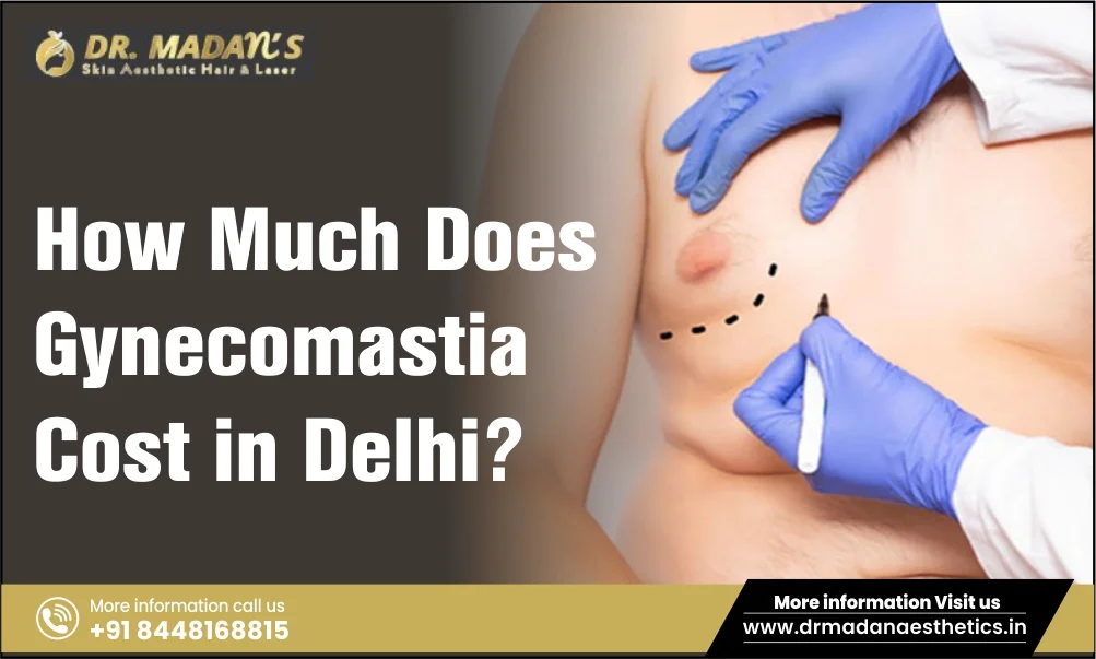 You are currently viewing How Much Does Gynecomastia Cost in Delhi?