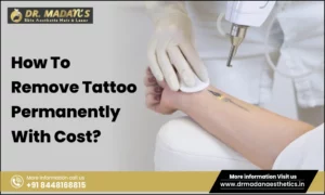 Read more about the article How To Remove Tattoo Permanently With Cost?