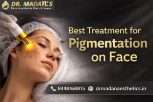 Read more about the article Best Treatment for Pigmentation on Face