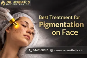 Read more about the article Best Treatment for Pigmentation on Face
