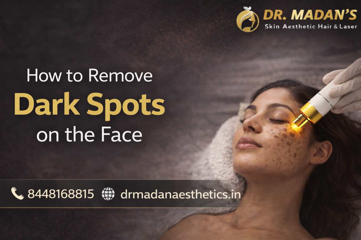 You are currently viewing How to Remove Dark Spots on Face: Expert Insights by Dr Madan Aesthetics