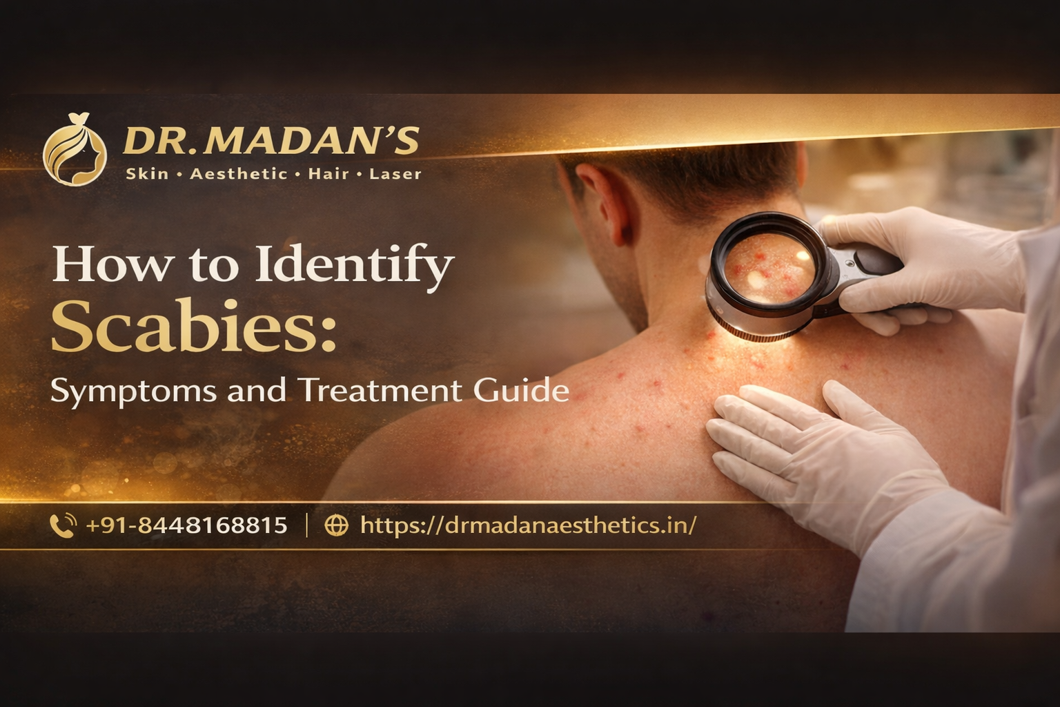 You are currently viewing How to Identify Scabies: Symptoms and Treatment Guide