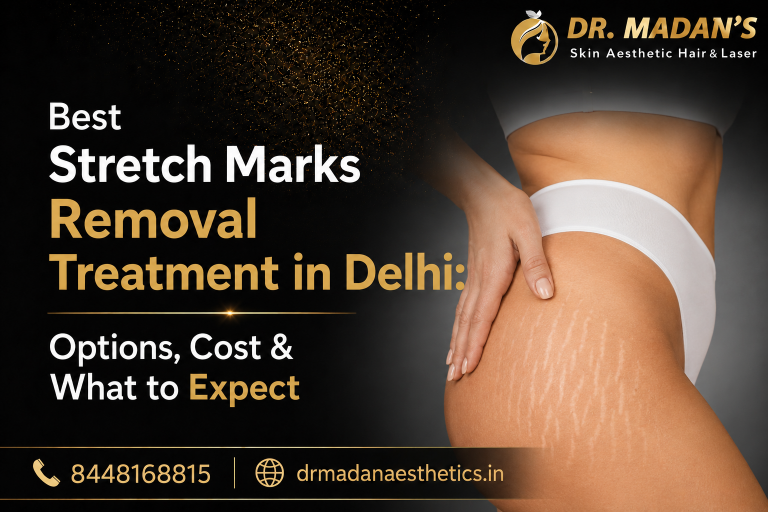 You are currently viewing Best Stretch Marks Removal Treatment in Delhi: Options, Cost & What to Expect